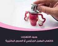 عوامل تسبب الاجهاض المتكرر